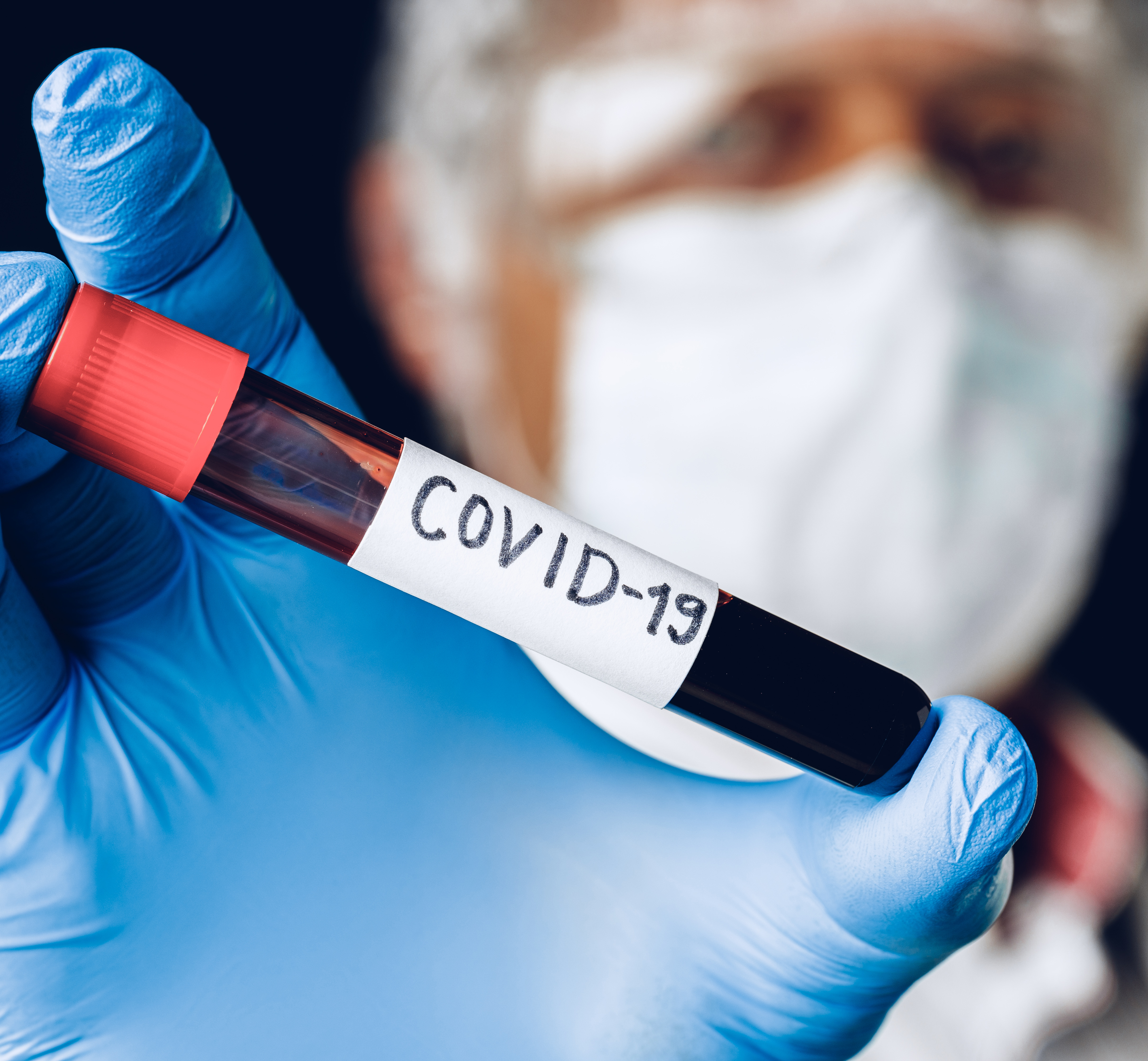 Biomédico explica as diferenças dos exames para identificar Coronavírus
