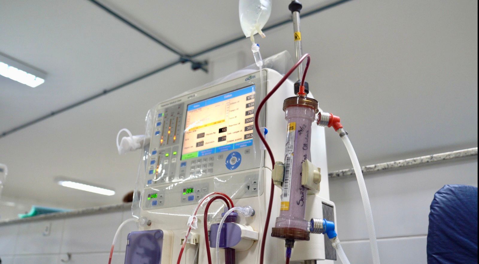 Santa Casa de Votuporanga: O elo que conecta pacientes à esperança do transplante